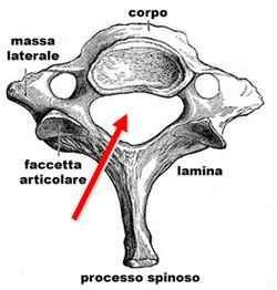 MIELOPATIA CERVICALE SPONDILOGENETICA DEFINIZIONE La mielopatia cervicale spondilogenetica è una patologia degenerativa cronica, con decorso generalmente ingravescente, dovuta ad un danno di origine