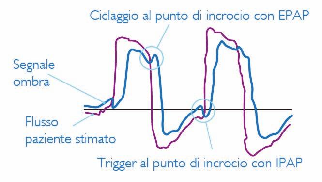 Il vero motore di questo sistema intelligente per la terapia del sonno è un particolare algoritmo di dimostrata efficacia clinica, definito Digital Auto-Trak Sensitivity.