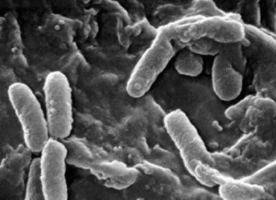 Bacilli Enterobacteriaceae: Escherichia coli, Salmonella, Shigella, Yersinia pestis Legionella pneumophilae
