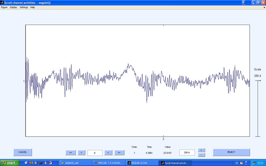 EEG/fMRI simultaneo. Variazioni del segnale in funzione del tempo: serie temporali.