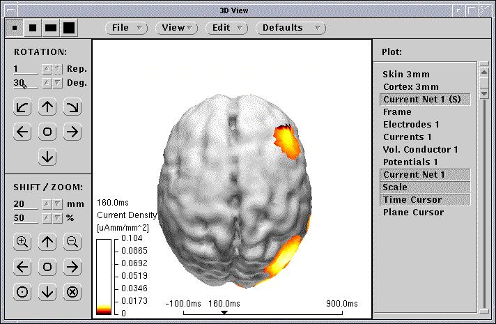 Il Neuroimaging multimodale permette di vedere la morfologia e la funzionalità delle strutture cerebrali.