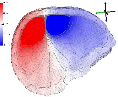 subtraction potential approach in a three compartment