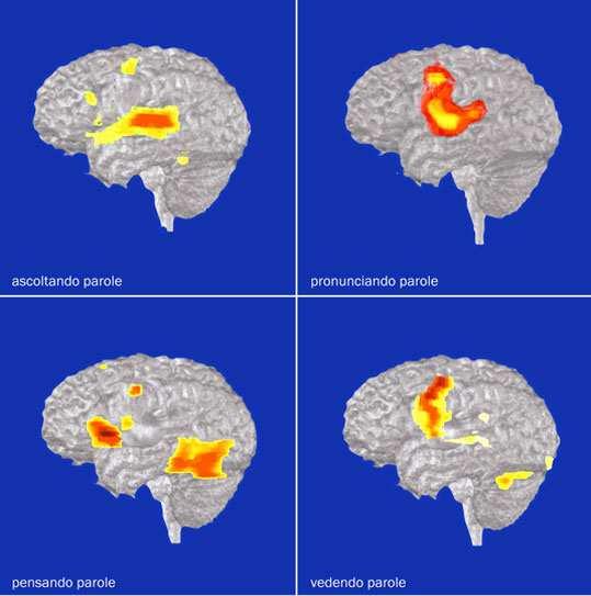 sopra Le nuove frontiere delle applicazioni cliniche della Pet riguardano gli studi in campo neurologico, in particolare sulla malattia di Alzheimer e sul morbo di Parkinson.