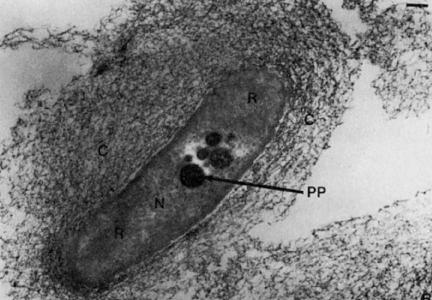 capsula; R: ribosoma; PP: polifosfato scala: 0,1 micrometro (da Slots J,