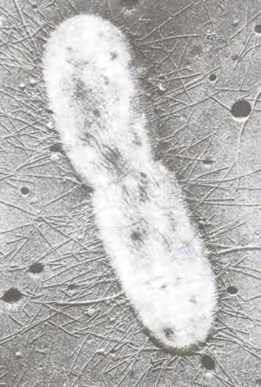 Pili (fimbrie) Immagine al M.E. di Escherichia coli. Sono strutture proteiche rigide (0,2-20 µm) presenti soprattutto nei Gram- sulla superficie esterna della cellula.