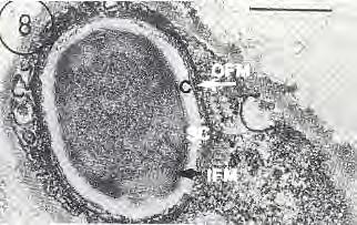 prespora si depositano peptidoglicano modificato e dipicolinato di calcio (sintesi della corteccia); si realizza l assemblaggio del rivestimento proteico esterno con