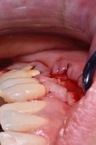 risoluzione delle più comuni forme di