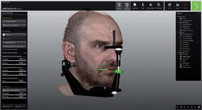 superiore e il Face Hunter, la Natural Head Position (NHP) del paziente e tutti i dati facciali