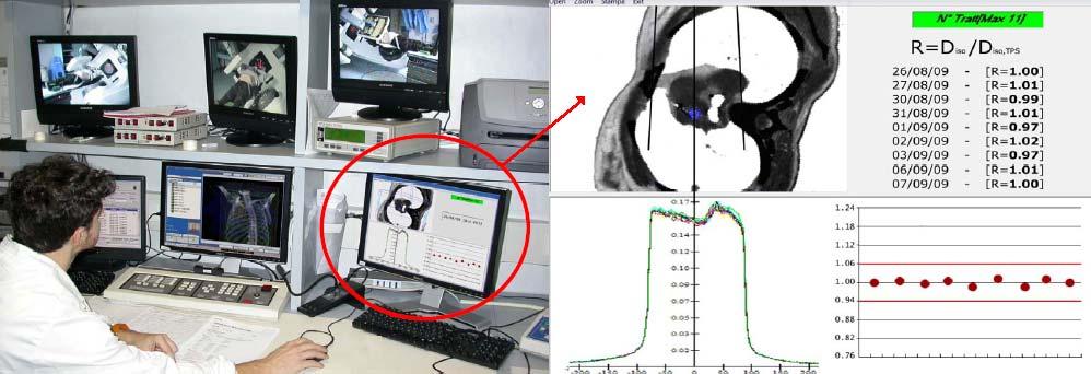 Il software DISO R Livelli di tolleranza: 5% per 3D-CRT 6% per il