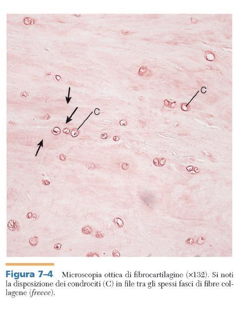 Condrociti disposti a file, presenza di fibroblasti Senza Pericondrio Fibre di collagene I oltre al tipo II, povero di aggrecano