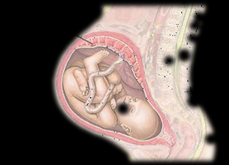 morbidità neonatale