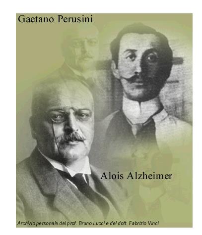Malattia di Alzheimer: definizione La malattia di Alzheimer, descritta inizialmente, nel 1907, dal tedesco Alzheimer e
