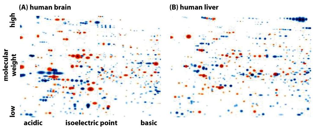 Proteine presenti in due differenti umani (elettroforesi bidimensionale di proteine) In rosso sono colorate