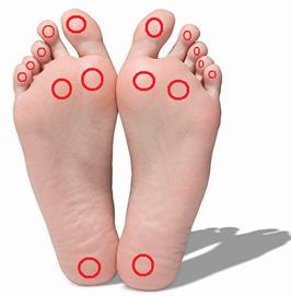 Esistono tipi diversi di ferite da piede diabetico? Sì. Le ferite possono essere di tipo neuropatico, ischemico o più di frequente un misto di questi due tipi.