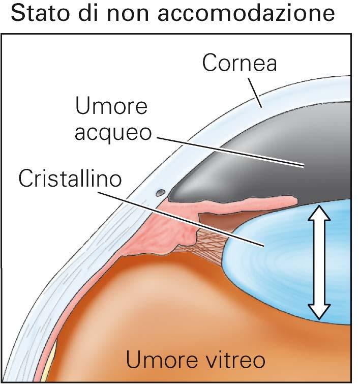 Accomodazione Aggiustamento della forma e del potere di rifrazione della lente x permettere la