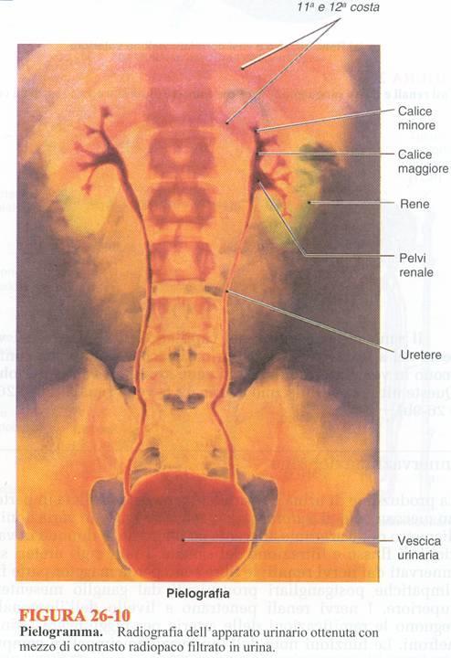 UROGRAFIA