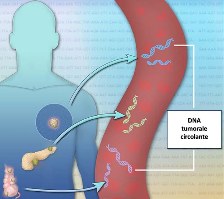 nella pratica clinica dell analisi delle cellule tumorali circolanti. Maggiormente utilizzata invece è la ricerca del DNA tumorale circolante il cui impiego è entrato nella pratica clinica.