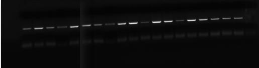 RELATIVE DENSITY RELATIVE DENSITY LIVELLI DI ESPRESSIONE GENICA DI TNF-α E IL-23 VALUTATI MEDIANTE RT-PCR SU PBMC DI PAZIENTI PSORIASICI TRATTATI CON WHITE T 0 T2 T 0 1,8 1,6 1,4 1,2 1 0,8 0,6 0,4