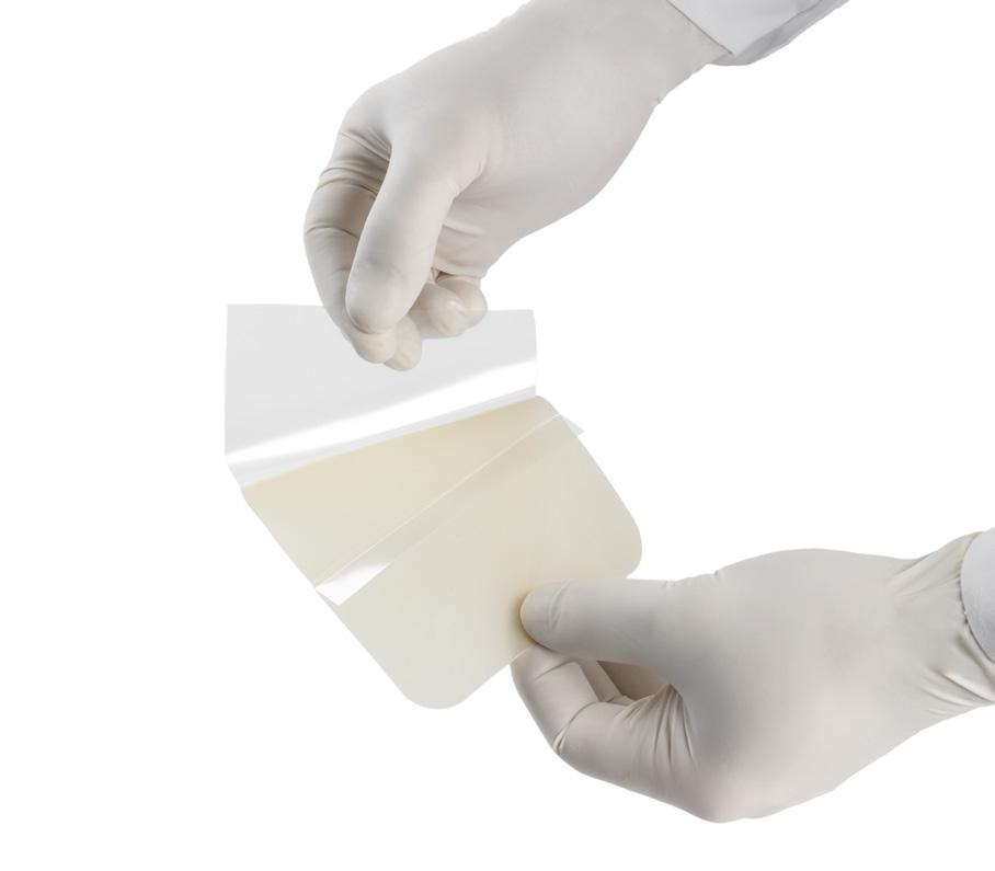 Derm Thin Sorb Sterile hydrocolloid dressing Sterile Hypor Derm is indicated for the treatment of non-infected chronic or acute ulcers, lightly to moderate exuding wounds, superficial abrasions and