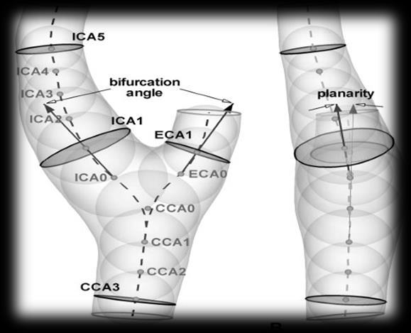 Presentazione della letteratura Considerazioni sulla geometria dell arteria: Geometry of the Carotid