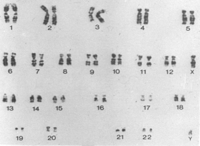 Il bandeggio dei cromosomi Il bandeggio è definito come la variazione di proprietà di colorazione del cromosoma nella sua lunghezza.