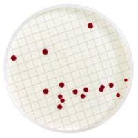 Aspetto tipico delle colonie: Le colonie assumono una colorazione rossa dovuta alla riduzione del trifeniltetrazolio cloruro (TTC) COLIFORMI TOTALI KIT (NPA) COLIFORMI TOTALI (MF) Kit per la ricerca