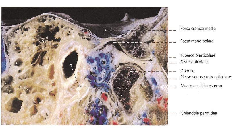 Articolazione temporo-mandibolare disco articolare capsula spazio temporo-meniscale spazio