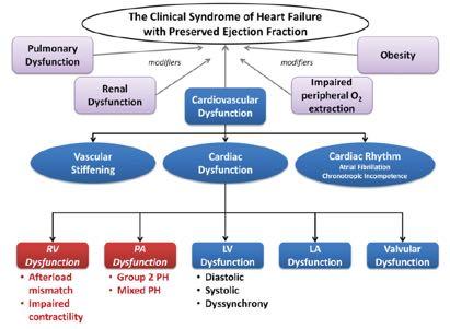 Heart failure with preserved EF: a forest of a variety of trees HR of 5.
