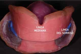 73 Aspetto occlusale del vallo inferiore con in evidenza le sporgenze che vanno ad incastrarsi negli incavi del vallo superiore.