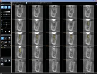 3D Software semplice per una soluzione semplice Flessibile e funzionale Il sistema Kodak 9000 3D è dotato di un software di acquisizione delle immagini