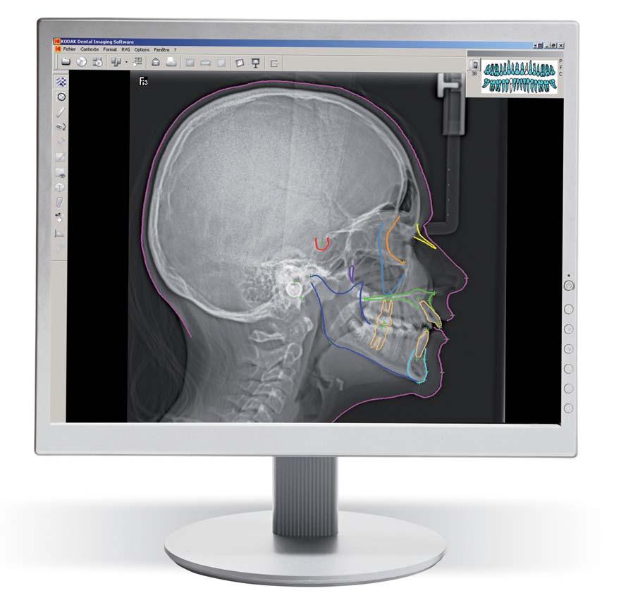 Cefalometrica Esclusiva funzione di tracciatura automatica Dall immagine ai tracciati in un batter d occhio Il software del sistema è in grado di riconoscere punti di riferimento e strutture