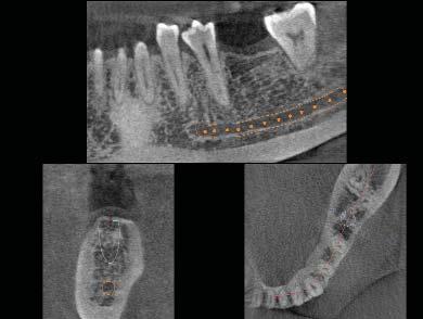 Nuove diagnosi sicure Una nuova prospettiva Il sistema Kodak 9000 3D fornisce un nuovo modo di analizzare le strutture dentali e le relative patologie.