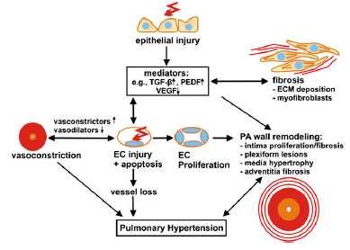 Pulmonary Hypertension and Idiopathic Pulmonary Fibrosis