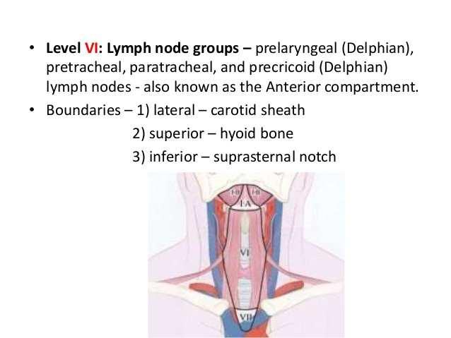 bilateral central neck dissection.