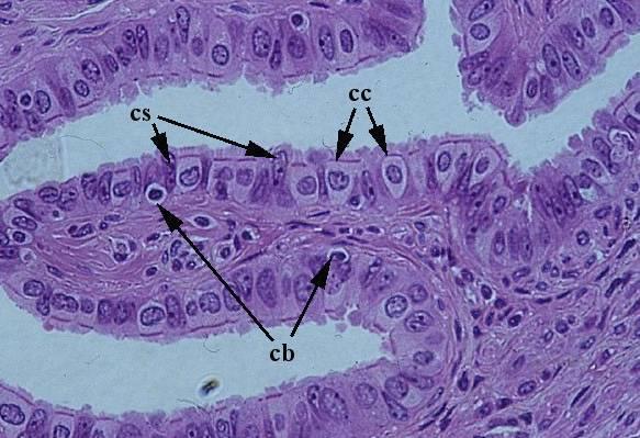 TUBE UTERINE: