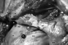 a: coracoide; o: testa omerale ricoperta dalla cuffia dei rotatori; a: acromion; cl: clavicola; ac: legamento acromio-coracoideo; ct: legamenti coraco-clavicolari esterni, conoide e trapezoide; cli: