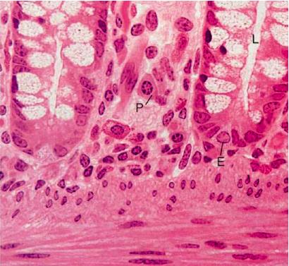 cellulare Può mancare in alcune cellule