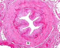 Uretere prossimale e distale Entrambi epitelio di