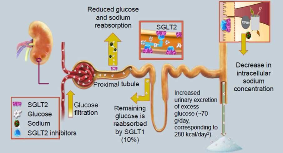 Inibitori SGLT-2 o glifozine MECCANISMO D AZIONE: inibiscono il co-trasportatore di sodio-glucosio 2 (SGLT2) a livello del tubulo renale prossimale riducendo il riassorbimento di glucosio.