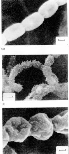 L aspetto della superficie delle singole spore