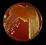 Staphylococcus: batteri aerobici facoltativi; spesso producono un pigmento colorato (S.