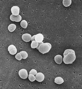 aureus (pigmentato, patogeno che causa infezioni polmonari, articolari e meningiti) e S.