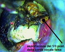 vocale falsa. Fig. 9.