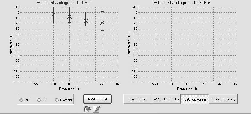 OAE/ABR Screening Refer Outcome Normal? Wave I Wave I-V 20 db nhl Click ABR Abnormal ABR or No Response Tone Burst ABR or OAEs Delayed Wave I? Bone Conduction ABR Wave I only?
