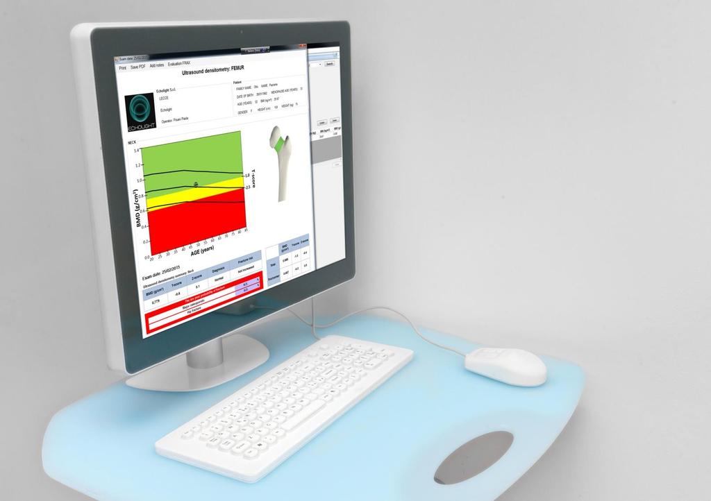 Referto Medico Il referto fornisce tutti i parametri standard per la diagnosi dell Osteoporosi: BMD (g/cm²), T- Score, Z-Score sia per le vertebre lombari che per il collo del femore.