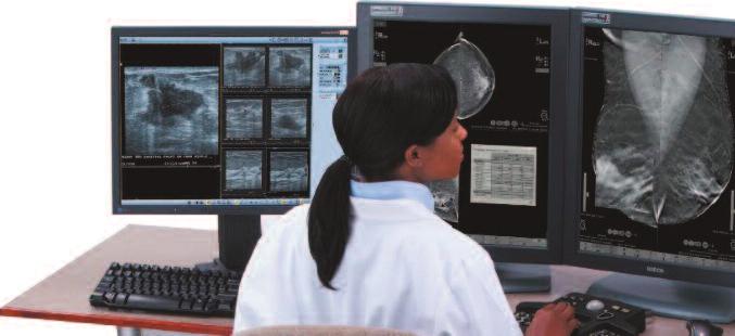 Tomosintesi La tomosintesi della mammella è una tecnologia diagnostica digitale tridimensionale, evoluzione dell'attuale mammografia, con la quale le immagini vengono acquisite da diverse