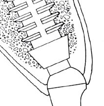 Bicon mantiene ancora oggi lo stesso design. Ora disponibile negli Stati Uniti. Stryker acquista il sistema Implantare DB Precision Fin della Driskell Bio-Engineering.