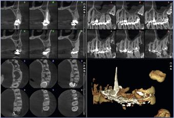 Caratteristiche principali Tecnologia avanzata Le nostre soluzioni e algoritmi high-tech intelligenti garantiscono una geometria di imaging ideale, una perfetta usabilità e immagini cristalline prive