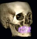 ortodontici per l analisi cefalometrica Immagini postoperatorie e di follow-up nella chirurgia maxillo-facciale Studi delle vie aeree Studi del seno Pianificazione impianto Riduce la dose efficace