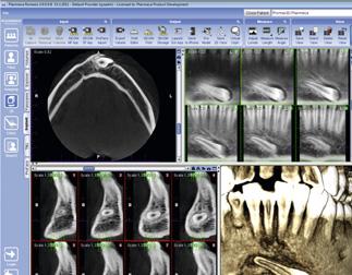 Planmeca Romexis Reinventare l imaging 3D Il nostro innovativo software Planmeca Romexis offre strumenti progettati appositamente per gli implantologi, gli endodontisti, i parodontologi, i